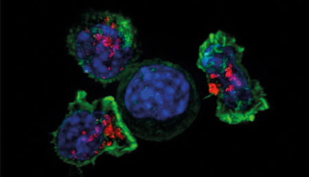 CARTsol: células CAR-T ocultas en biocápsulas para atacar tumores sólidos desde el interior