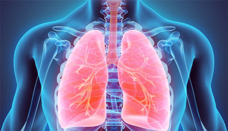 Exceso de peso y resultados de los inhibidores del punto de control inmunitario anti-PD-1 en el cáncer de pulmón no microcítico