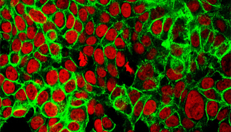 Descubren un biomarcador de buen pronóstico en cáncer de colon