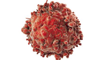 Científicos generan por primera vez una leucemia humana de linfocitos T a partir de una célula sana