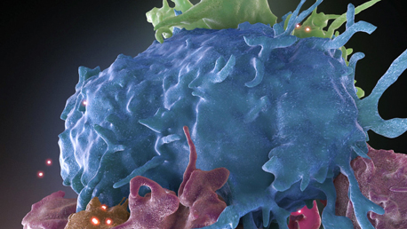 El trasplante de células madre que podría erradicar el VIH