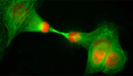 ¿Cómo las células cancerosas adquieren resistencia al tratamiento?