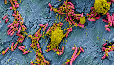 El zinc podría modular la virulencia de la bacteria <i>Escherichia coli</i>