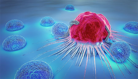 La hiperactivación de P70S6K en el tumor se asocia inversamente con los linfocitos infiltrantes de tumores en el cáncer de mama triple negativo