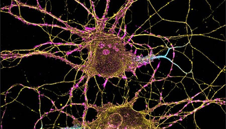 Científicos revierten la enfermedad de Parkinson en ratones