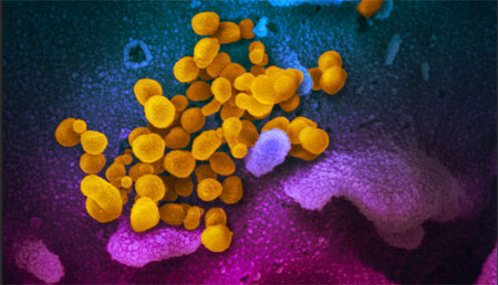 El interactoma como herramienta para hacer frente al coronavirus