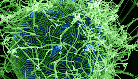 Desarrollan nuevas vacunas contra el virus del Ébola