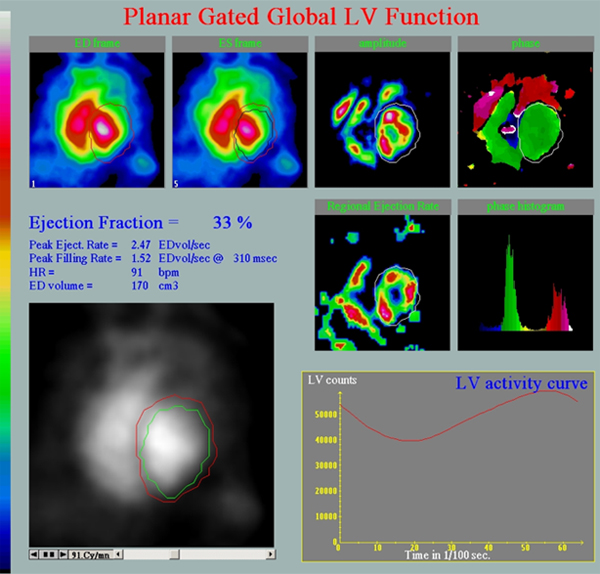 Figura 4 caso 2